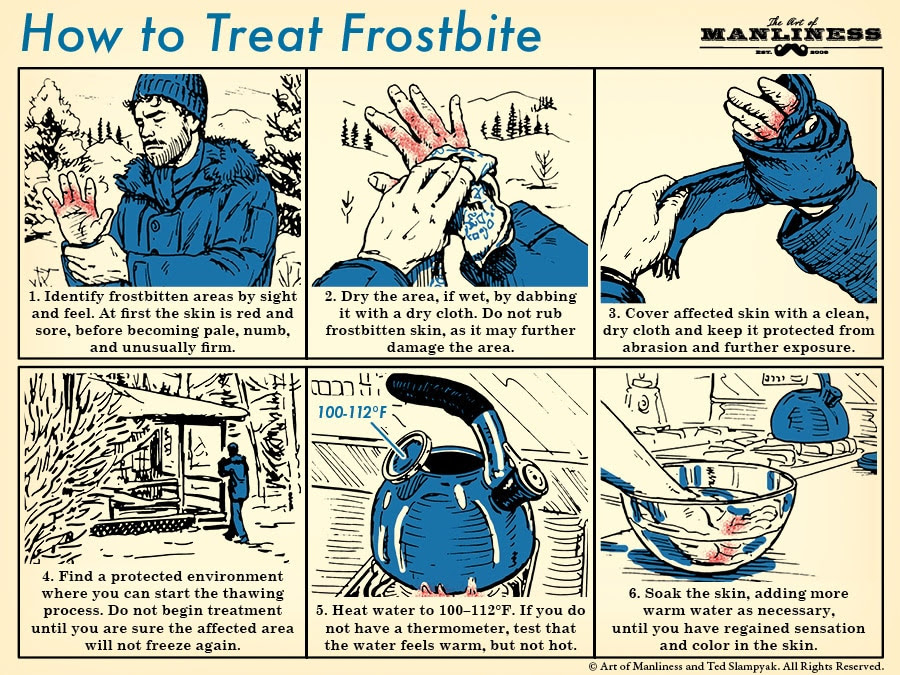 how to treat frostbite illustration diagram