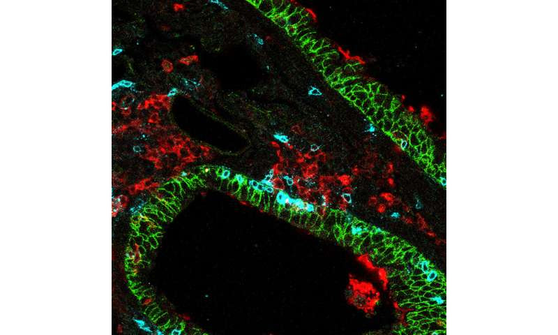 How targeting killer T cells in the lungs could lead to immunity against respiratory viruses