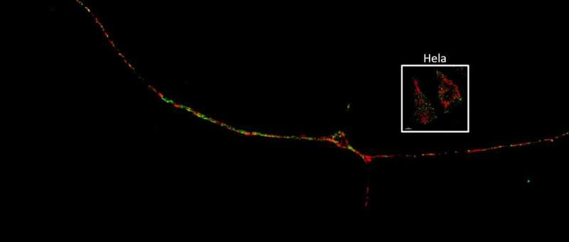 Interaction of mitochondria and lysosomes key in Parkinson’s disease