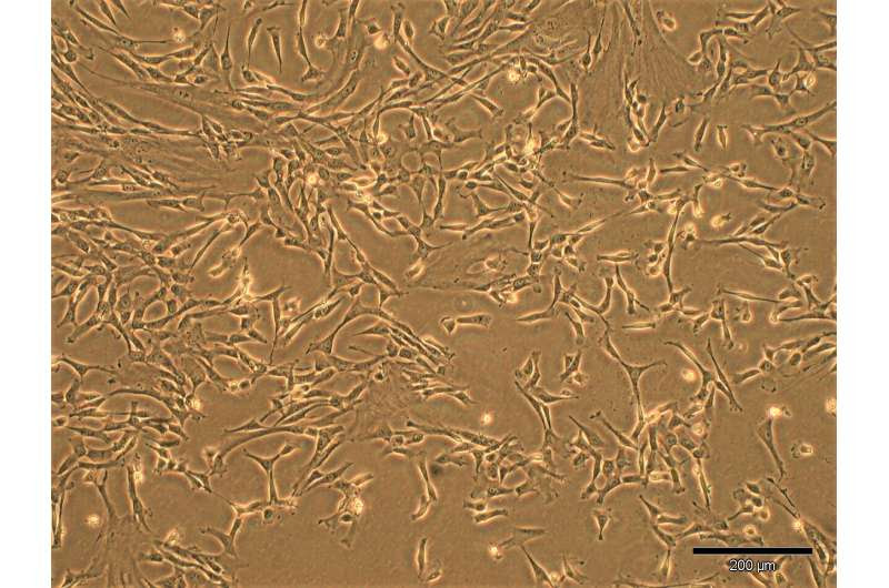 Thanks to umbilical cord stem cells: First successful treatment of severe pulmonary hypertension