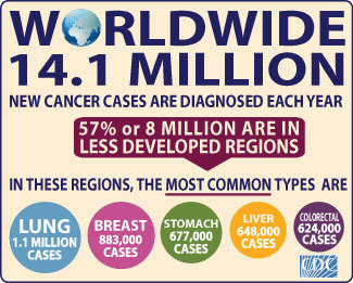 Infographic of the week 14.1 million cancer cases diagnosed each year. 57% are in less developed regions, where most common types are lung, breast, stomach, liver, colorectal