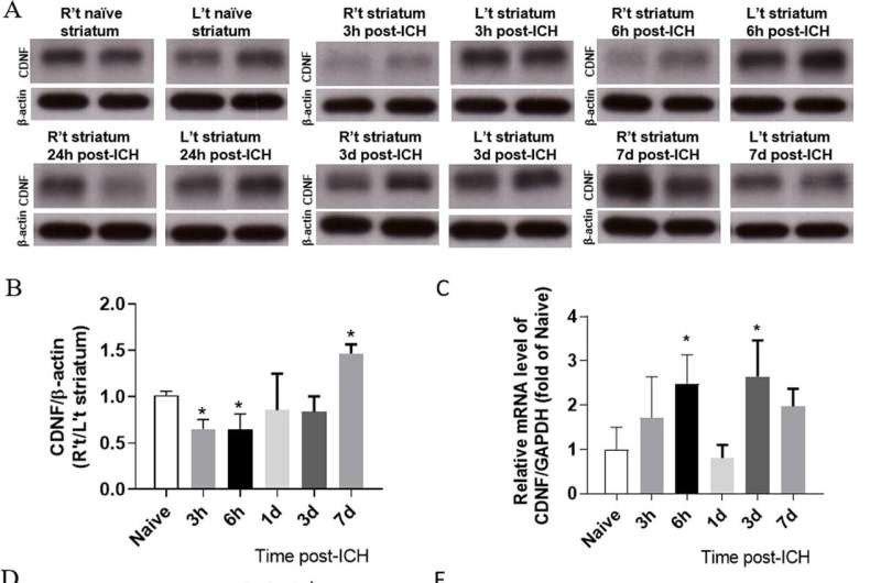 A novel waste removal factor treats brain haemorrhage