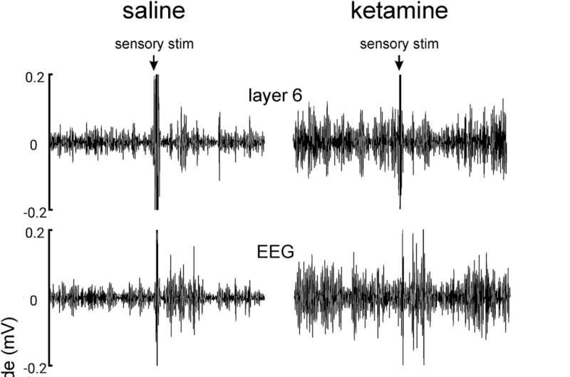 Ketamine found to increase brain noise