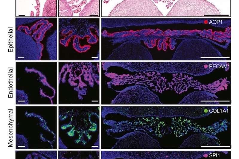 An 'atlas' of the brain's choroid plexus across the lifespan