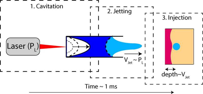 Needle-free injection evolves toward a highly precise, safe and low-waste technology