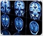 Brain stimulation improves visual perceptual learning