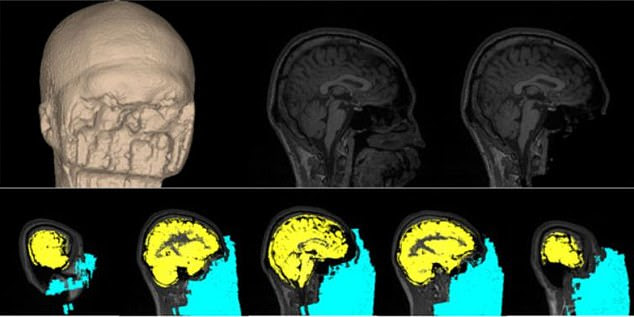 Scientists have developed a method which changes how a person's brain functions and it can be used to boost confidence and eradicate fears. Pictured, an anonymised person's brain scan