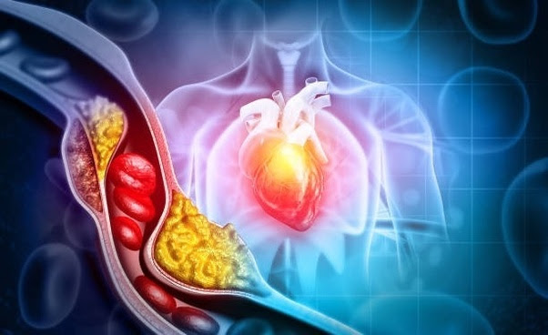 How do you lower your cholesterol without taking any medications? (Quora Digest) Main-qimg-f3ebbb14cf82dd16a2a0059846050e3e