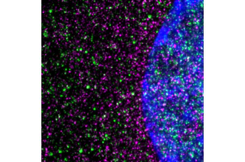 Huntington's disease driven by slowed protein-building machinery in cells