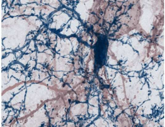 Inflammatory reactions in multiple sclerosis lead to synapse loss in the cerebral cortex