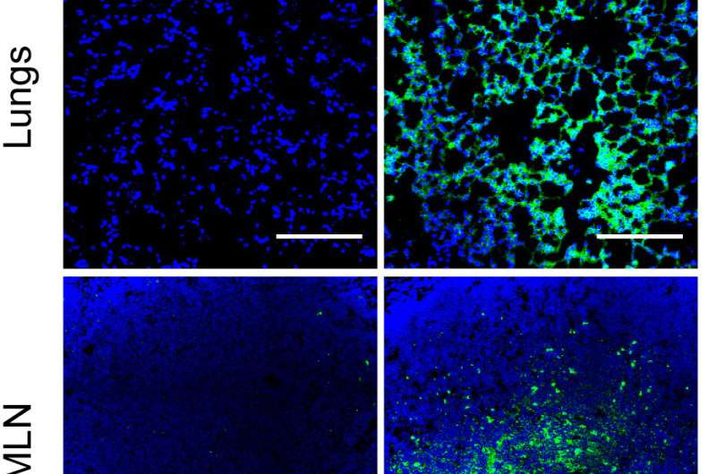 Delivering vaccines directly to the lungs can boost immune responses to respiratory infections or lung cancer: study