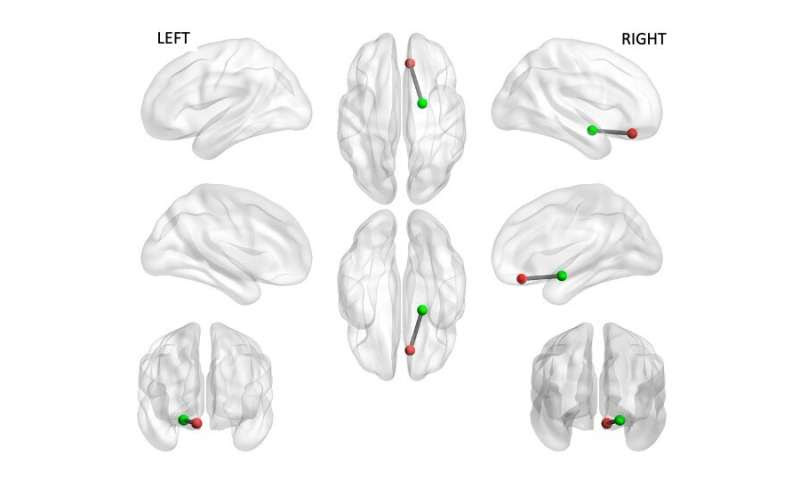 Smartphones can predict brain function associated with anxiety and depression