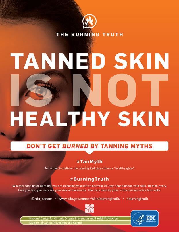 Tanned Skin Is Not Healthy Skin