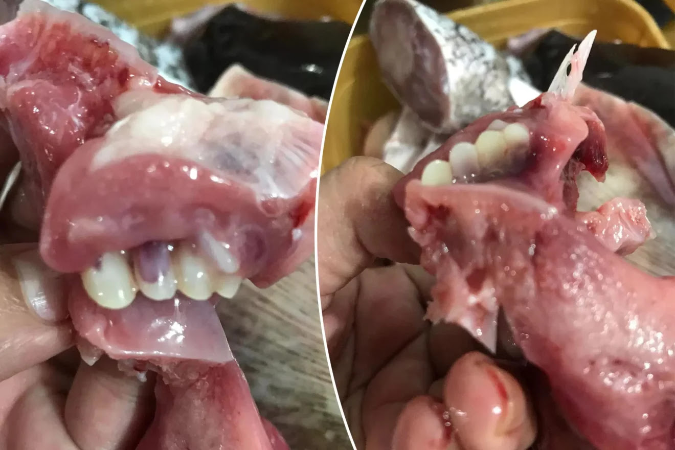 شاهد فلبينية تعثر على أسنان بشرية بسمكة الغداء