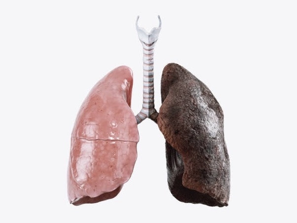 How do I clean my lungs? Main-qimg-815ae95dbd314c512d95ef367a6d40ed