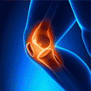 Osteoarthritic knee