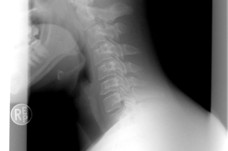 xray spine