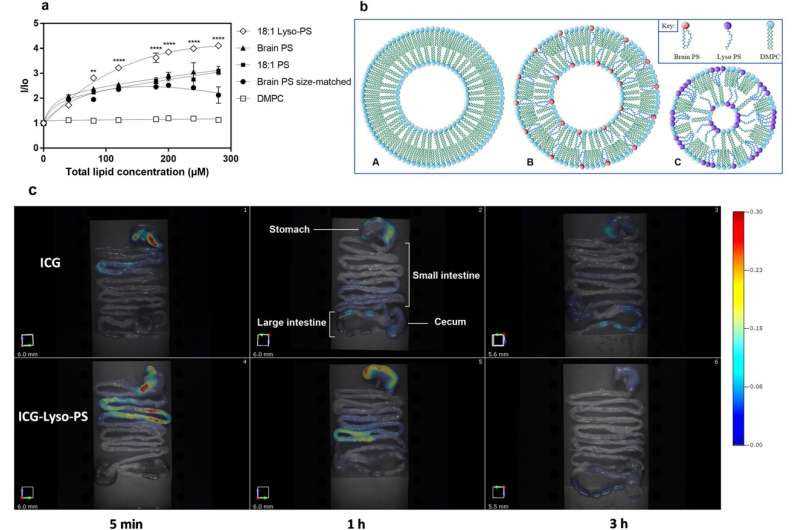 New treatment uses reverse vaccination to teach immune system not to attack life-saving drugs