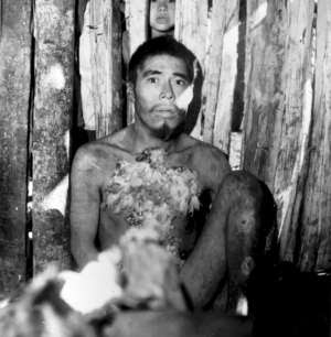 Hombre aché poco después de ser capturado en el bosque y de ser llevado a la Reserva Aché. Paraguay, 1972.