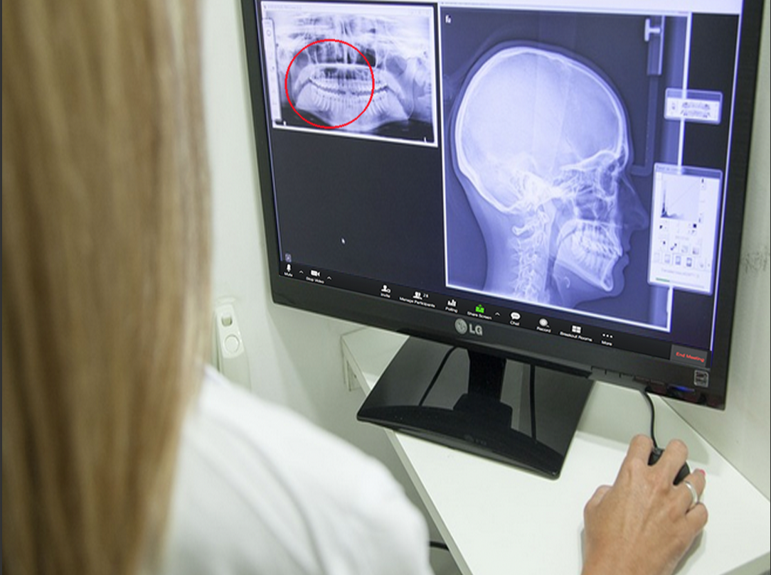 exhibit annotation in zoom doctor annotating x-ray and medical documents