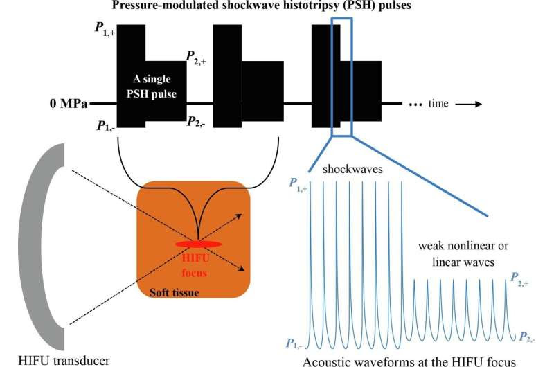 Development of precision focused ultrasound surgery technology destructing only the desired tissues