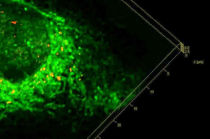 'Stressed' cells offer clues to eliminating build-up of toxic proteins in dementia