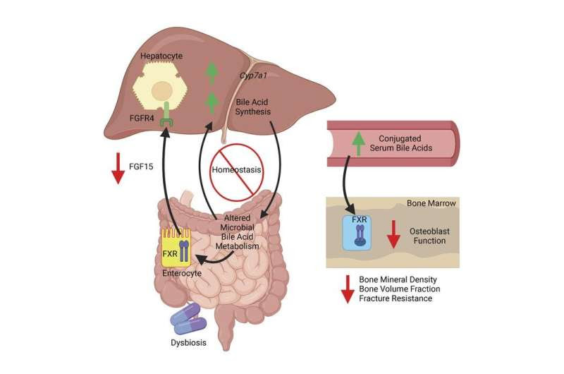 Treating acne with systemic antibiotics can have unintended consequences on maturing adolescent skeleton