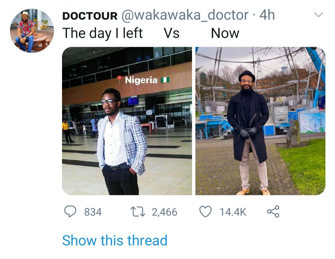 "The day I left vs now" Medical doctor shares photo of his transformation after leaving Nigeria for another country