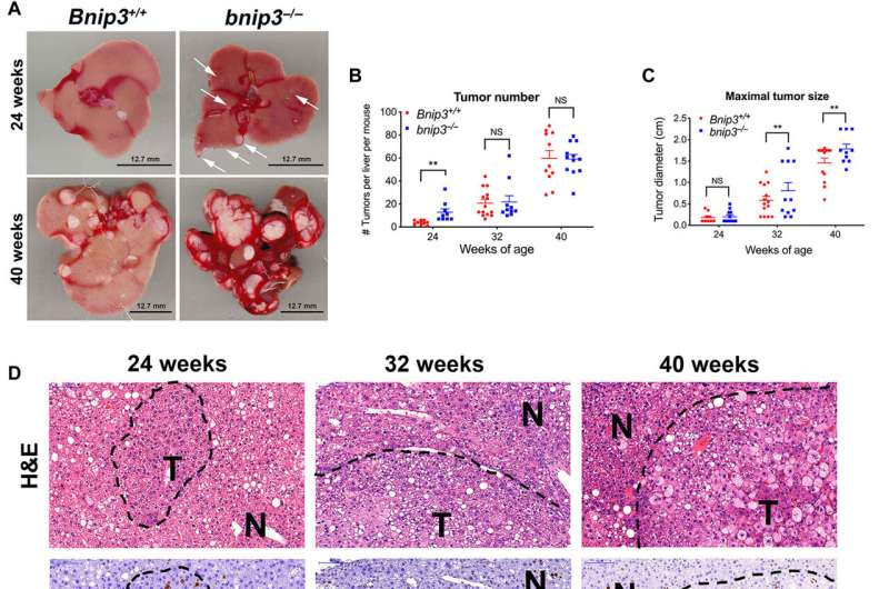 Increased mitochondria and lipid turnover reduces risk for liver cancer