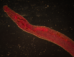 Therapy derived from parasitic worms downregulates proinflammatory pathways 