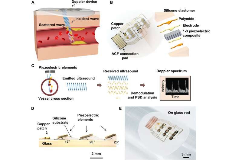 Monitoring blood flow velocity with a flexible Doppler Ultrasound device