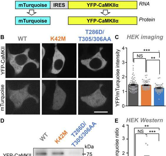 Stroke drug offers neuroprotection without long term impact on memory and learning