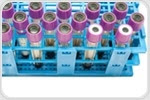 Extracellular Vesicles as Floating Cancer Biomarkers