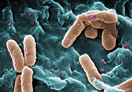 Pseudomonas aeruginosa bacteria (CDC)