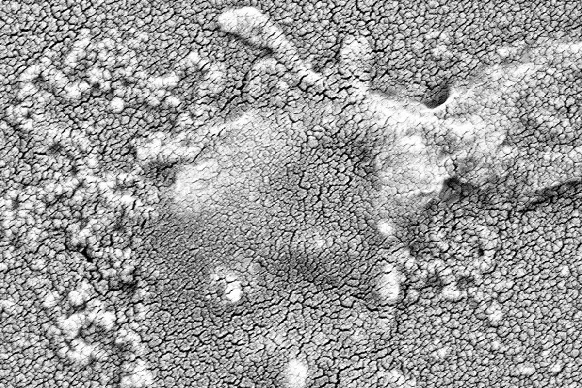 A microscope image of a drug-resistant K. pneumoniae bacterium that's burst open, thanks to a combination of a DsbA inhibitor and an existing antibiotic