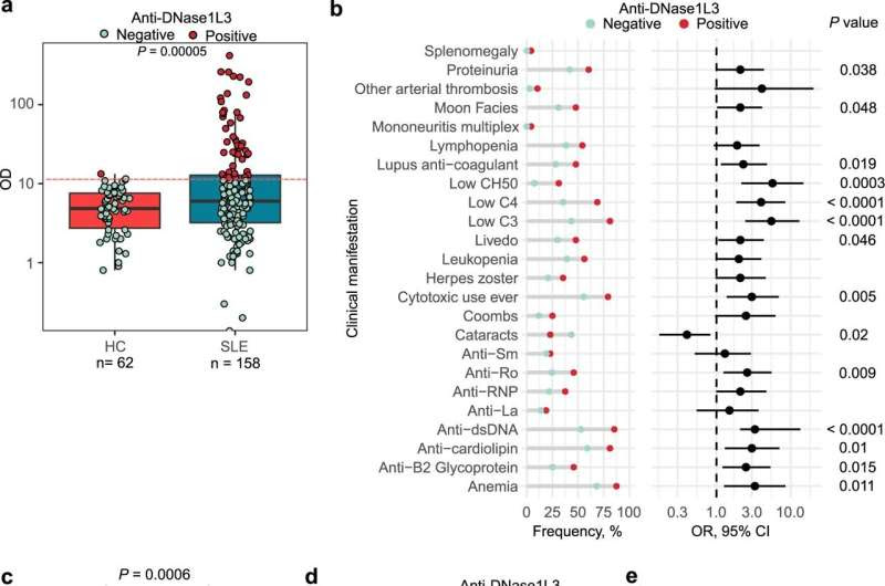 Researchers identify the origin of subset of autoantibodies that worsen lupus