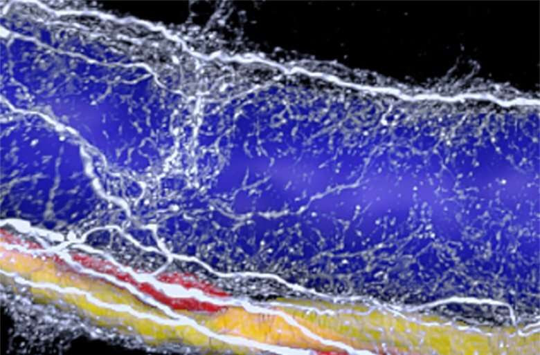 3D imaging reveals neural 'vicious cycle' in fatty liver disease