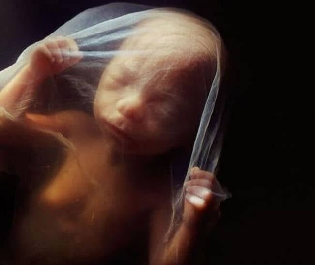 Những bức ảnh đáng kinh ngạc về sự phát triển của thai nhi trong bụng mẹ - 14