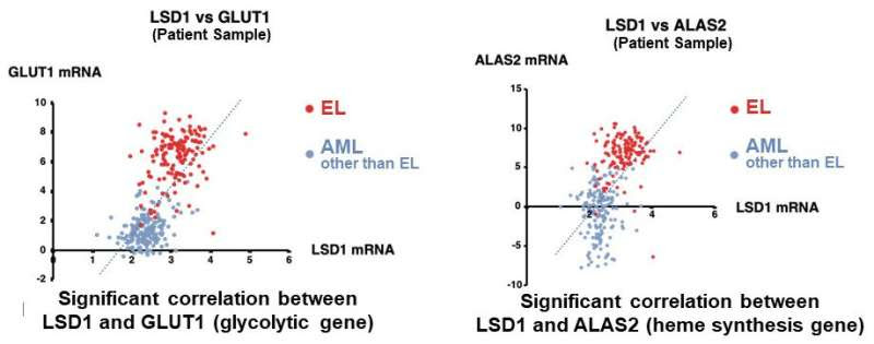 Unraveling the mechanisms that create the individualized metabolism in leukemia