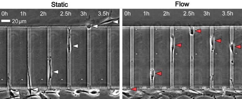 Protein appears to prevent tumor cells from spreading via blood vessels