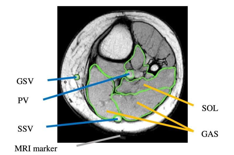 Leg muscle action assists blood flow independently of age