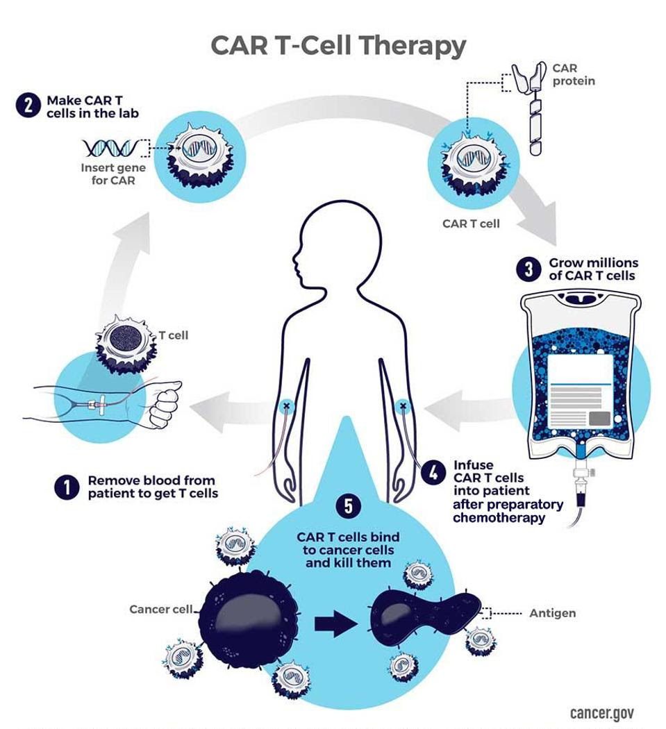 Process of CAR T therapy