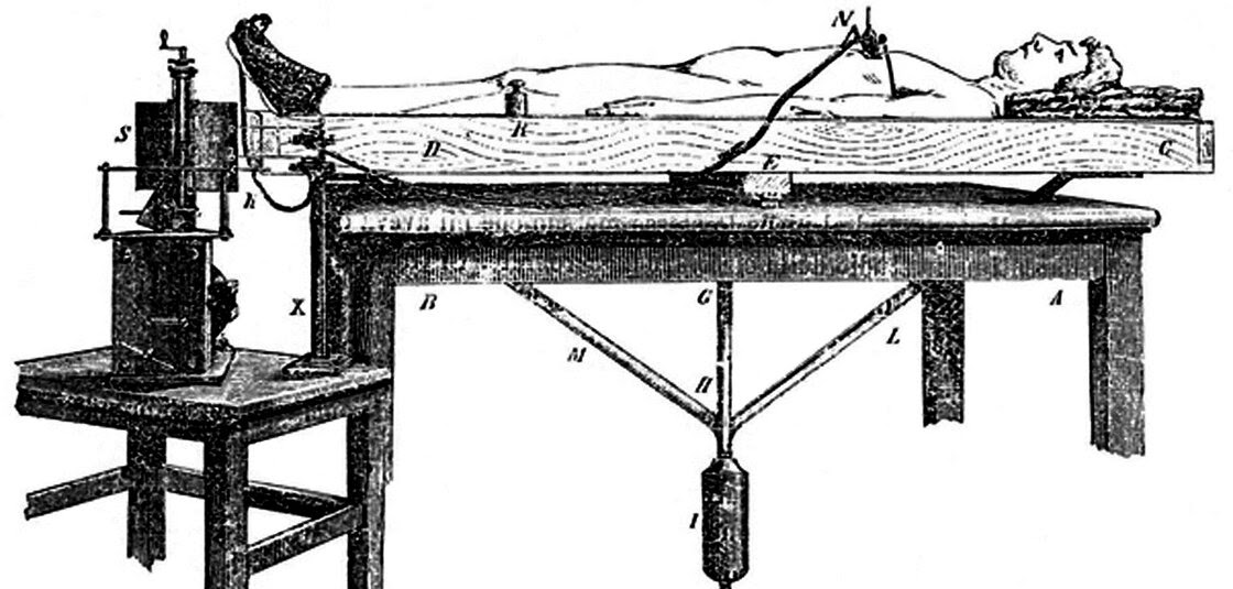 Angelo Mosso's "human circulation balance" machine worked like a seesaw to measure blood flow changes to the brain.