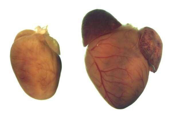 Gene therapy corrects mutation responsible for common heart condition, research shows