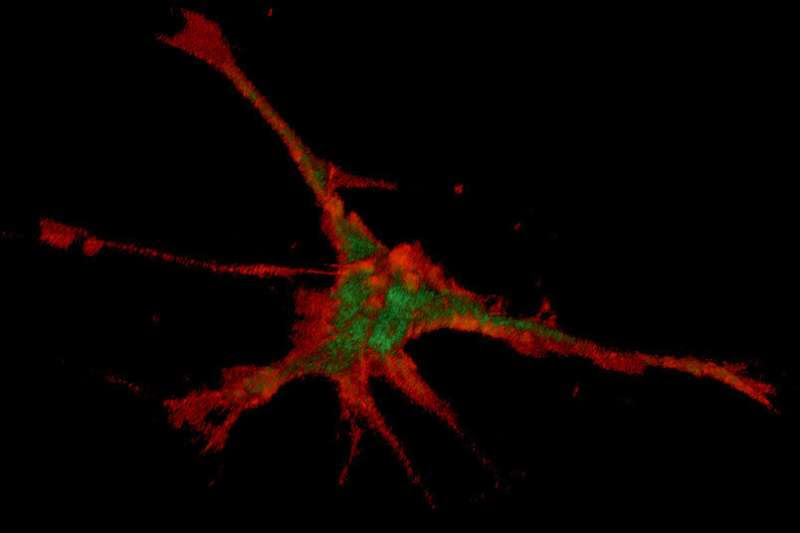 Parkinson's: Initial steps to show nerves their growth direction magnetically