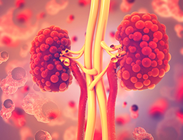 kidney cysts