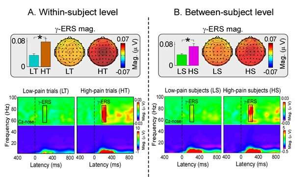 Pain-related gamma-band oscillations reflect pain perception