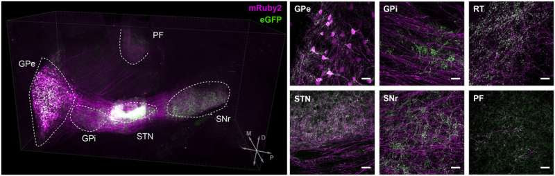 Study identifies two neuronal populations associated with symptoms of Parkinson's disease