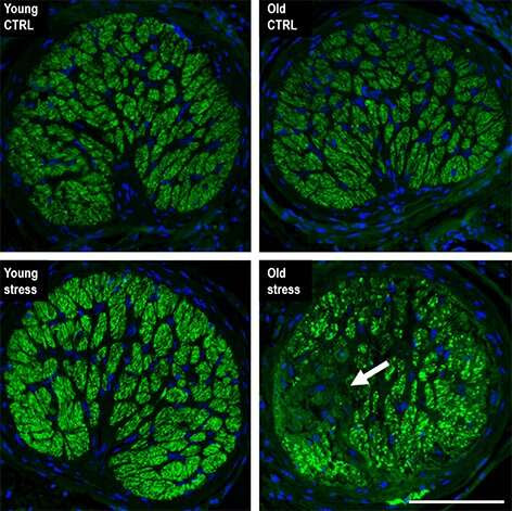 New UCI-led study shows repeated stress accelerates aging of the eye