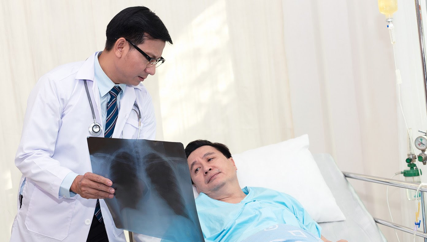 Doctor Criticized For 'Smoker Shaming' After Telling Man He Has Lung Cancer